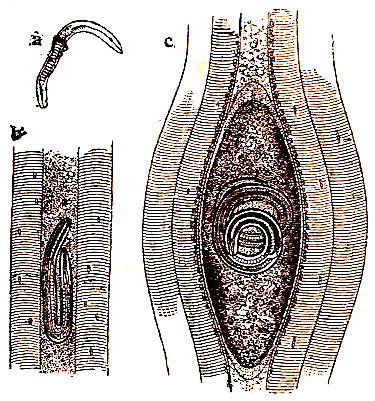 Triquina. a, larva. b, larva introducida en un musculo. c, ídem, enquistada (según Claus).